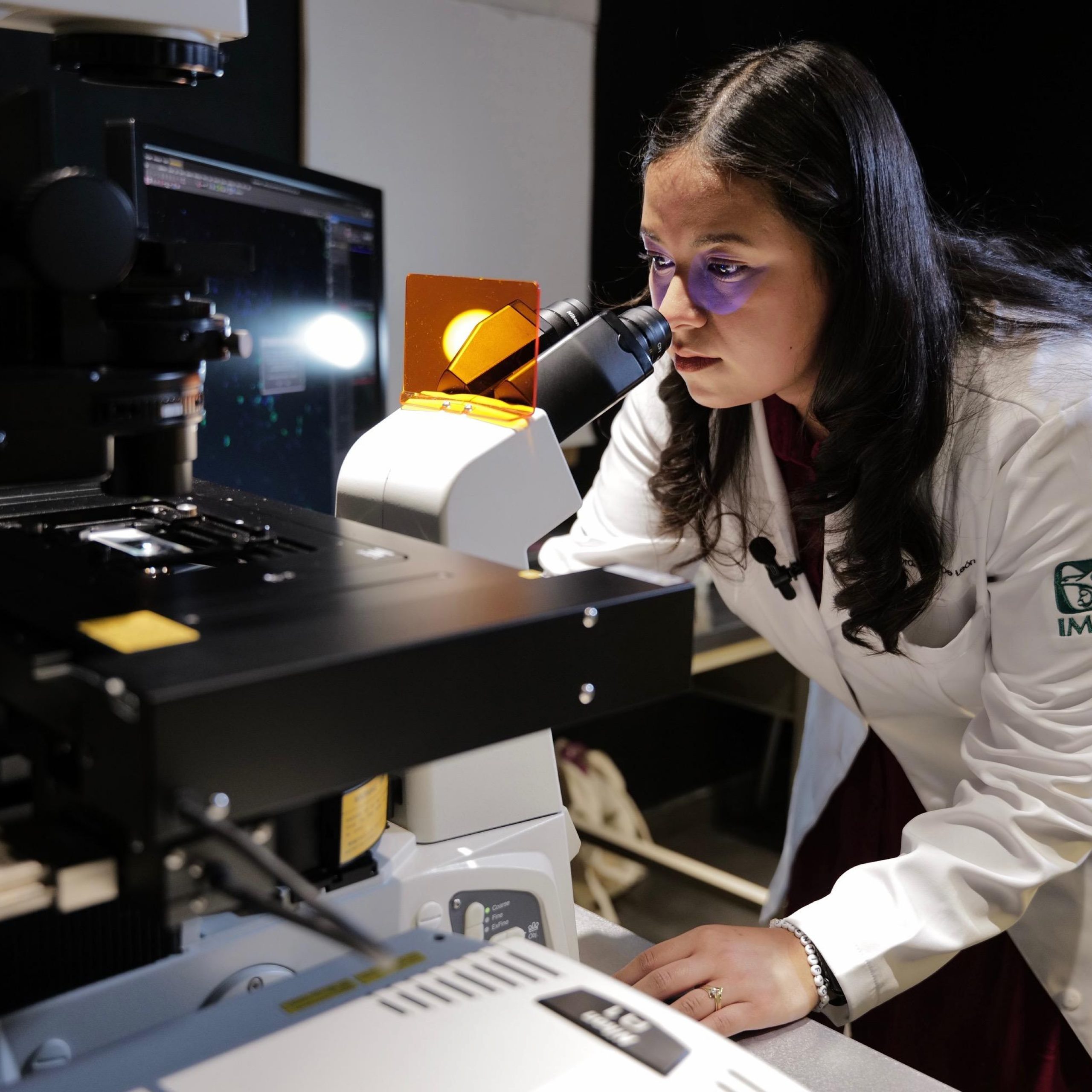 IMSS desarrolla Inteligencia Artificial (IA) para evaluar respuesta a inmunoterapia en pacientes con melanoma