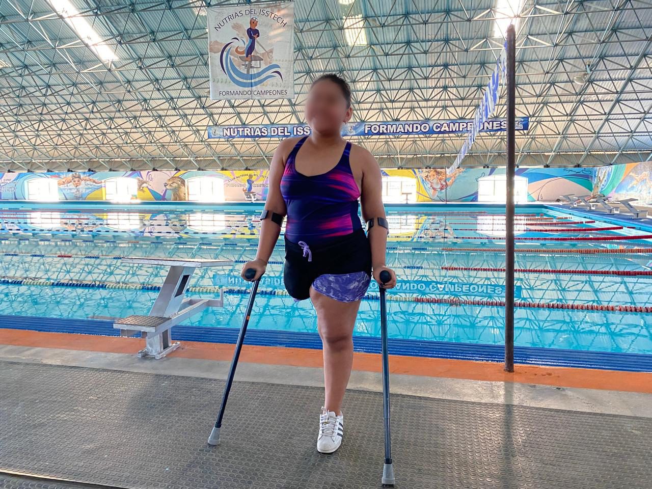 Supera paciente del IMSS cáncer óseo y es campeona de natación en Chiapas