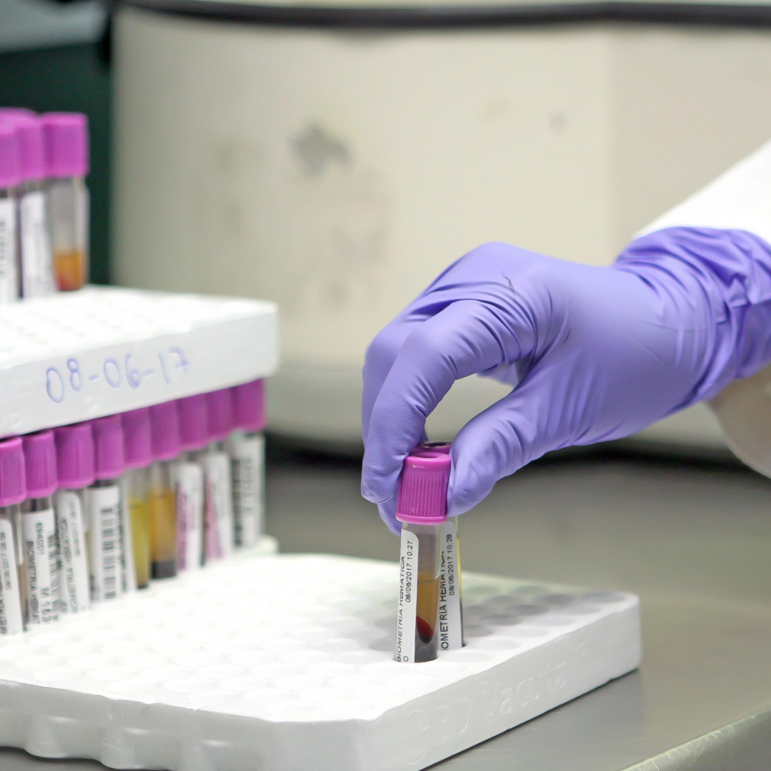 Aplica IMSS tratamientos innovadores a pacientes con hemofilia